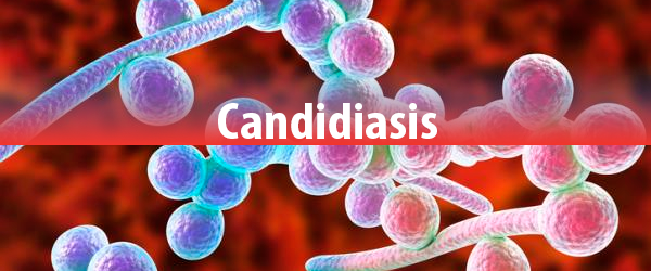 Candidiasis